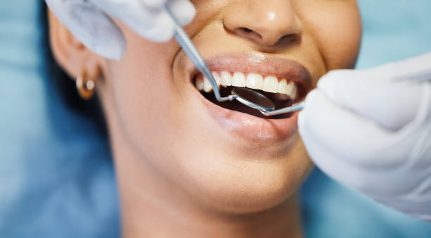 Best Emergency Gum Treatment in Riverview, DE